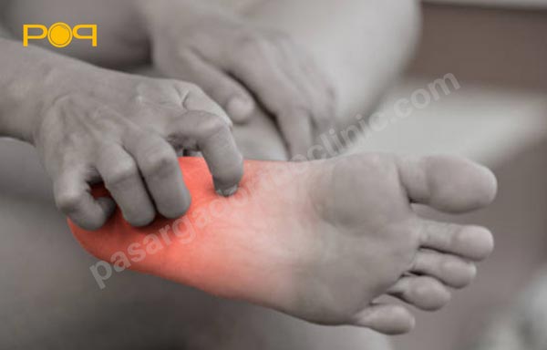 توصیه‌های لازم بعد از درمان درد پاشنه پا