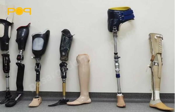 انواع مختلف پای مصنوعی