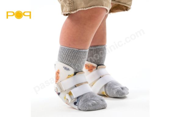 بریس برای درمان کف پای گود در کودکان