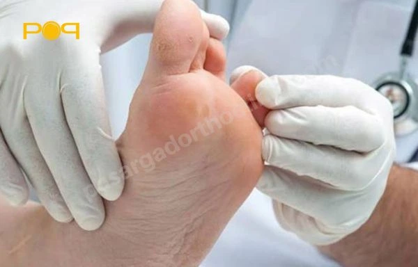 تقسیمبندی زخم پای بیماران دیابتی