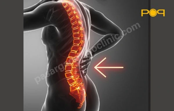 حرکات اصلاحی لوردوز