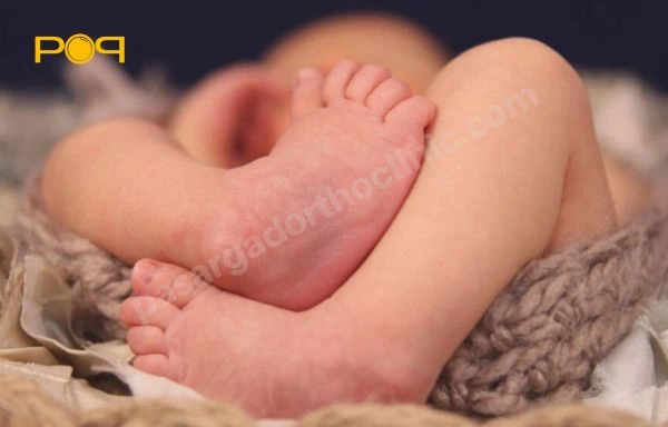 راهکارهای درمان پاچنبری (کلاب فوت): خانگی و غیر خانگی