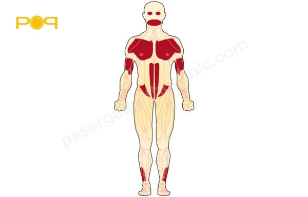 دیستروفی عضلانی فاسیو اسکاپولو هومرال یا صورتی-کتفی-بازویی (FSHD)