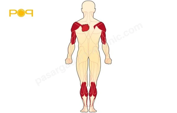 دیستروفی عضلانی لیمب-گیردل (LGMD)