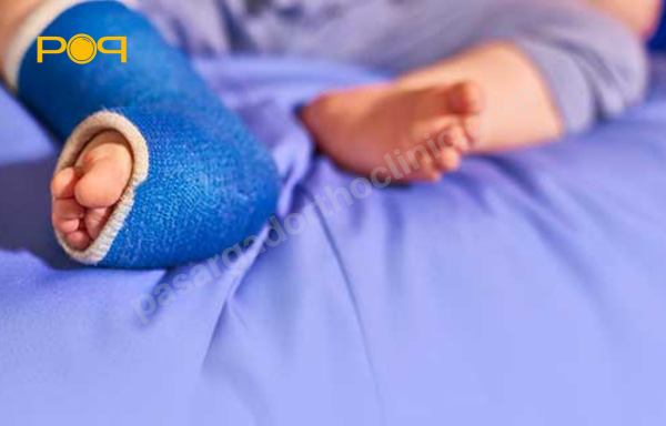 علل بروز عارضه پاچنبری یا کلاب فوت