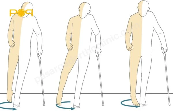 حرکات اصلاحی برای بهبود اختلالات راه رفتن